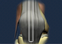 A Closer Look ACL Surgery Animation